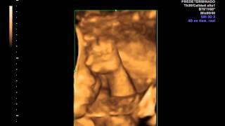 IMG 20130717 1 2 VolCine