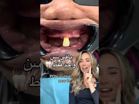 كيف تعالج سن واحد فقط    اكسبلور