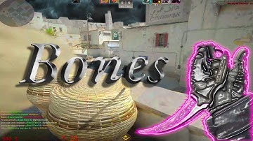 BONES 🔥 (CS2 MONTAGE)