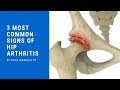 3 Most Common Signs of Hip Arthritis