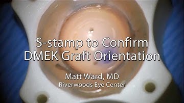 DMEK S Stamp to Confirm Graft Orientation