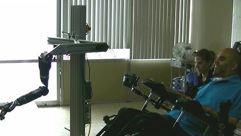 New tech helps quadriplegic control robotic arm with mind
