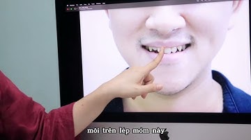 SỰ VI DIỆU CỦA NIỀNG MÓM | DR NGỌC ANH ƠI