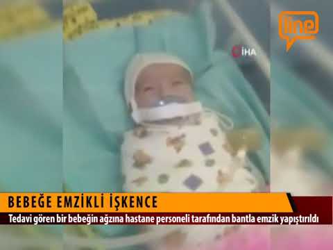 Kuvözdeki bebeğe emzik işkencesi