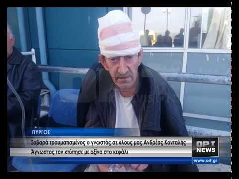 Πύργος: Σοβαρά τραυματισμένος ο Ανδρέας ο άνεργος – Άγνωστος τον χτύπησε με αξίνα στο κεφάλι