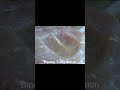 Electrosurgical Unit Bipolar Coagulation Working Effect