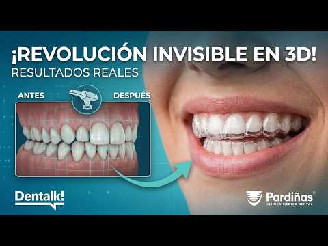 Ortodoncia invisible: Así funciona el tratamiento
