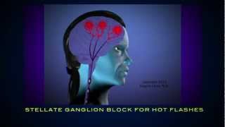 Eugene Lipov, M.d. Spotlight Therapy Sgb For Hot Flashes