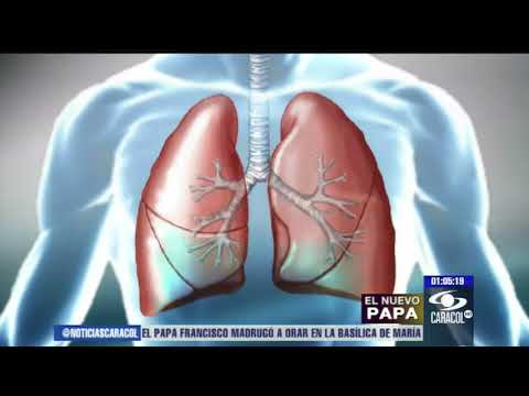 Vídeo: El papa té 1 pulmó?