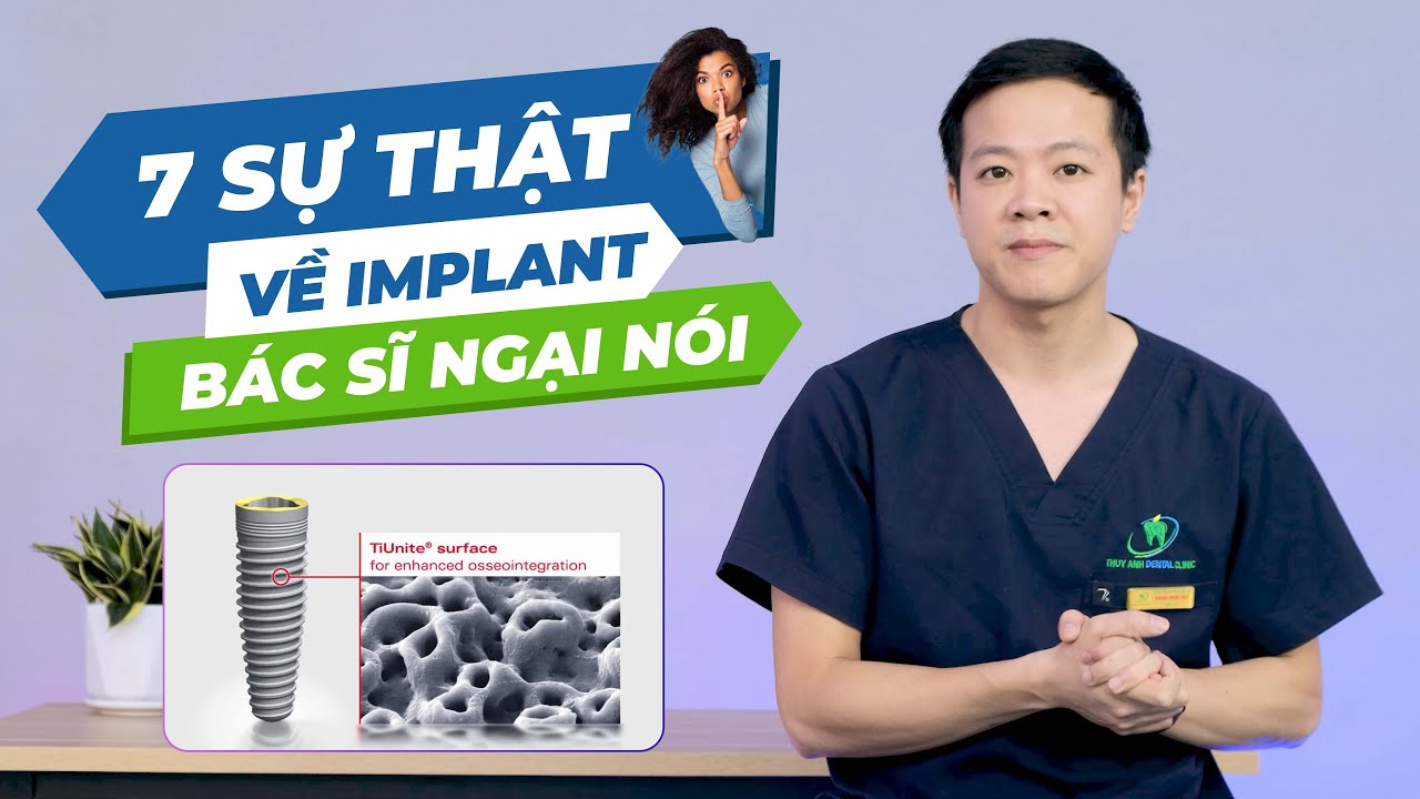 Outline Video 7 Điều Bạn Nên Biết Trước Khi Trồng Chân Răng Nhân Tạo Implant