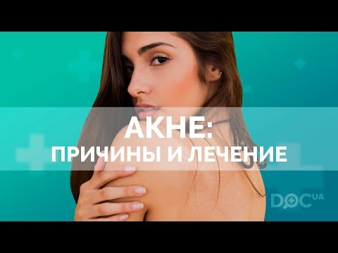 Акне: причини і лікування. Основні методики лікування вугрів