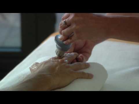 Болезненная кисть, экзостозы мелких суставов кисти