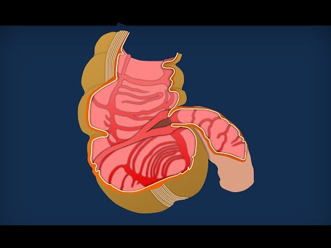 Apparato digerente 12: Intestino crasso - Anatomia macroscopica