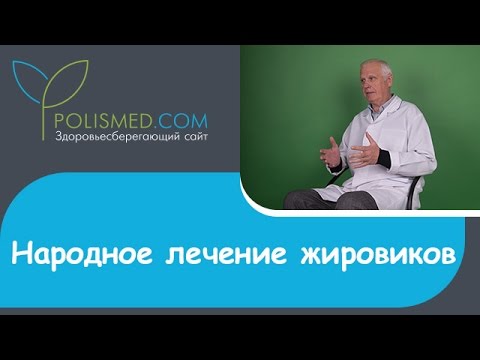 Народное лечение липомы: луком, йодом, свеклой, чесноком, перекисью водорода, чистотелом, корицей