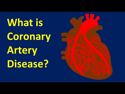 Video: Un ekg mostrerebbe le arterie bloccate?