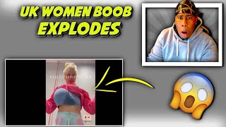 ONLYFANS MODEL BOOB IMPLANTS EXPLODES !! (REACTION)
