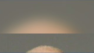 Dr. Brian Hyatt arrested by U.S. Marshals Net Worth