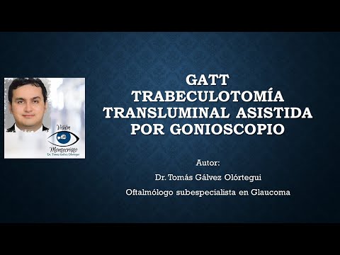 Vídeo: Observación Del Canal De Schlemm Y La Trabeculotomía Transluminal Utilizando Un Endoscopio Oftálmico: Reporte De Un Caso