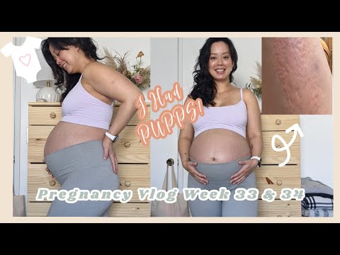 I HAD PUPPS! Pregnancy Vlog week 33 and 34 | @More Serein