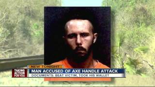 Police arrest man for robbing, beating victim with axe handle