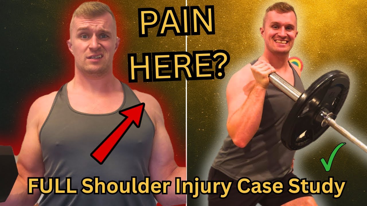 Как я, как физиотерапевт, провожу реабилитацию после травмы плеча от начала до конца.