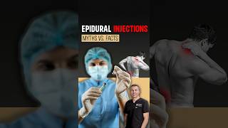 Epidural Steroid Injections Myths Busted | The Truth About Pain Relief