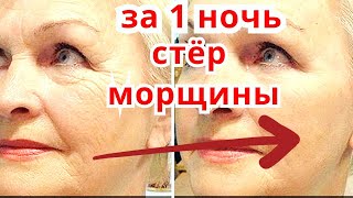 Как За Ночь Сделать Лицо Моложе на 5 Лет! Ночной Крем от Морщин/Рецепт