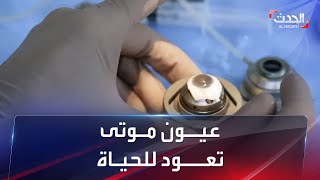 إنجـاز طبـي كبير قد يقلب الموازين بقضية الموت الدماغي