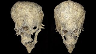 10 Most Bizarre Skulls & Skeleton Discoveries