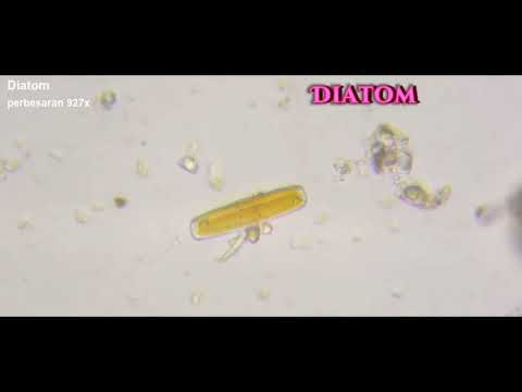 FITOPLANKTON by Yofa Fransisca #akuakultur #ubb #algae #pakanalami