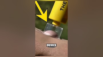 Dit apparaat kan je leven redden als je gebeten wordt door een giftige slang #shorts