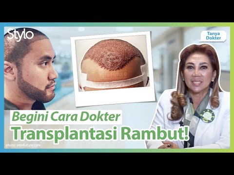Cara Transplantasi Rambut Tanam Rambut Jadi Solusi Kebotakan Rambut Banyak Artis Stylo Youtube