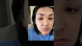 when you have an allergic reaction to eyebrow tint #fail #oopsididitagain