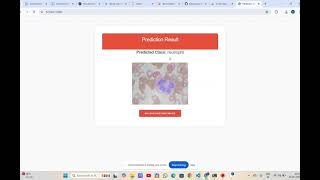 HematoVision: Advanced Blood Cell Classification Using Transfer Learning