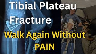 Tibial Plateau Fracture: 3 Exercises to Walk Without Pain Again