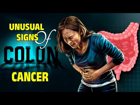 6 Unusual Signs of COLON CANCER People ACCIDENTALLY Ignore for Years! #ColonCancer