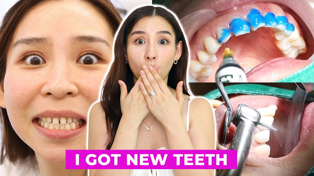 I Got a Dental Makeover in Korea 😬 🦷