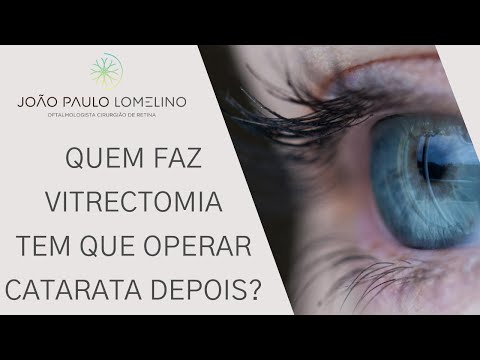 Quem faz vitrectomia