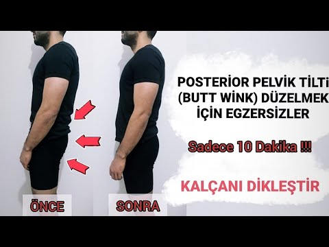 Fizyoterapistten Posterior pelvik Tilti Düzeltmek İçin Egzersizler | Kalçalarını Dikleştir