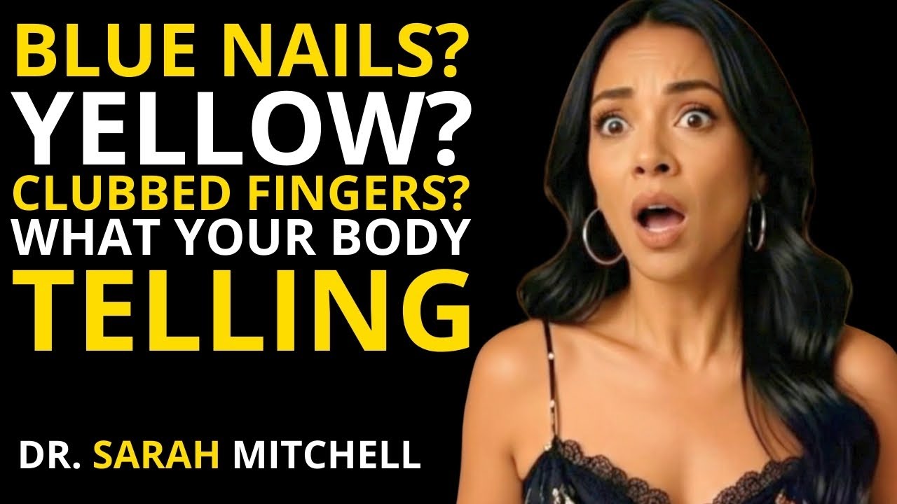Your Fingernails Are Warning You: Blue = Lungs, Yellow = Liver, Clubbed = Heart Disease