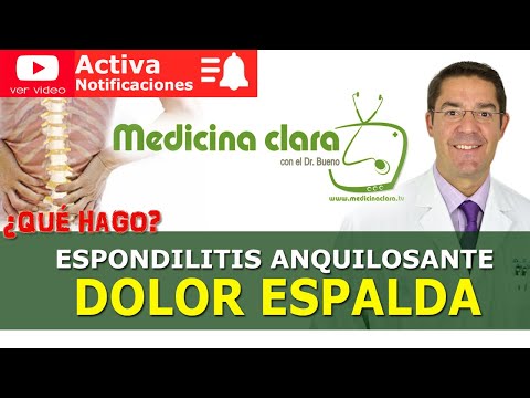 Vídeo: Espondilitis Anquilosante: Una Causa Pasada Por Alto De Dolor De Espalda Duradero