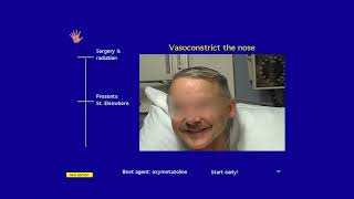 Awake Intubation Made Easy from AOD