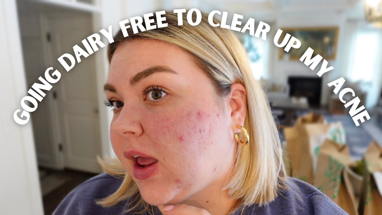 dairy free experiment to see if it clears up my acne