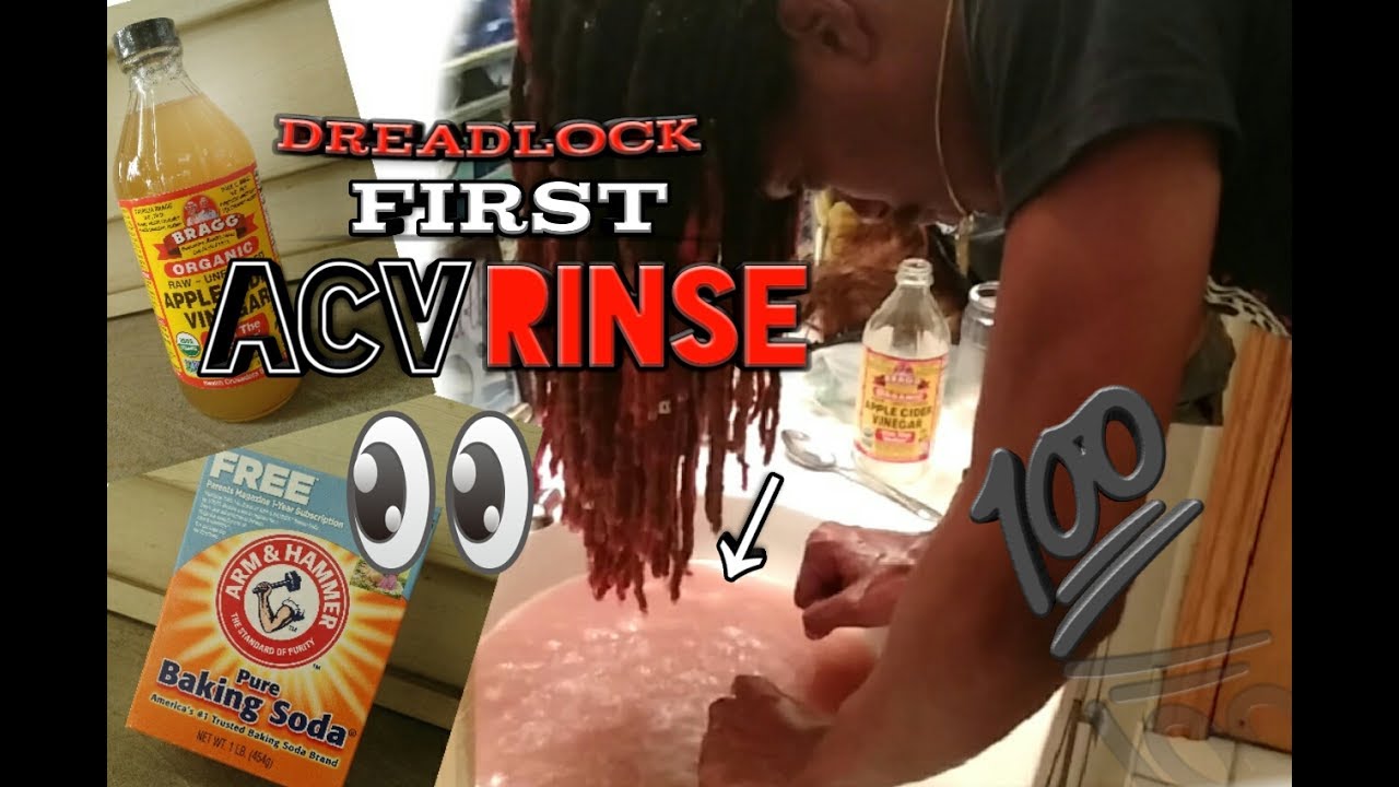 DreadLock Journey | ACV Rinse - YouTube