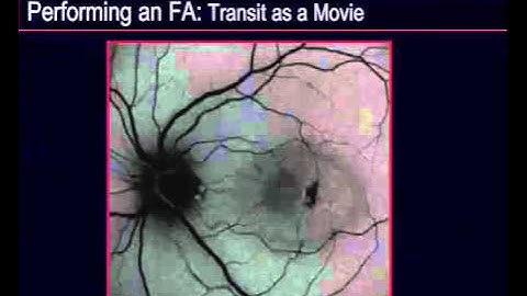 Capturing FA & ICGA Images With the SPECTRALIS®