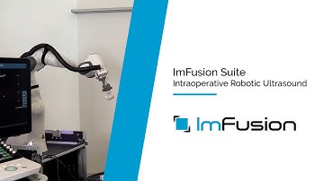 ImFusion Suite Robotics Module: Enabling advanced intra-operative navigation with robotic ultrasound