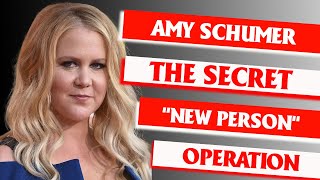 The Secret "New Person" Operation: Inside Amy Schumer's Radical Post-Surgery Transformation