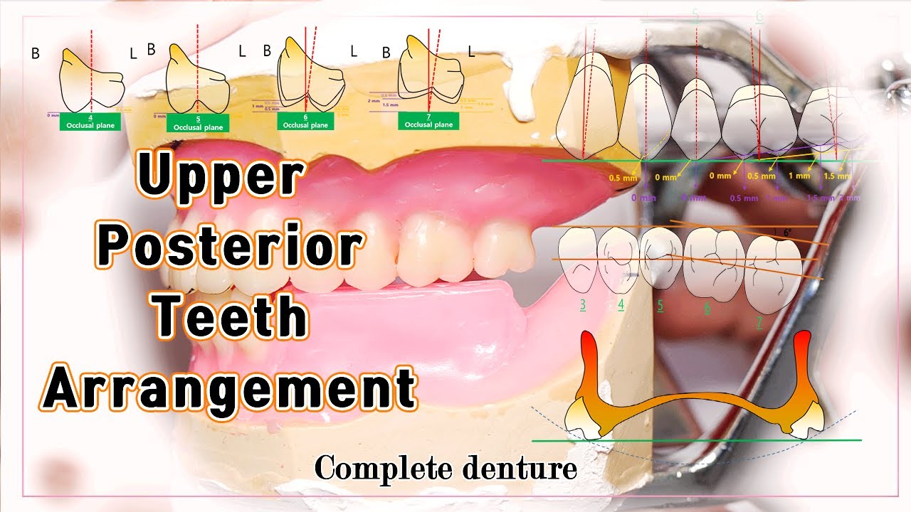 상악 구치부 배열 Upper Posterior Teeth Arrangement [4K]