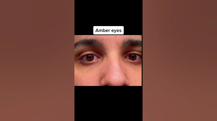 The rarest eye colors in the world😳 #shorts - DayDayNews