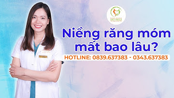 Thời gian niềng răng móm bao lâu?